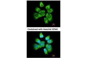 ICC/IF Image Immunofluorescence analysis of methanol-fixed A431, using AHA-1, antibody at 1:500 dilution. (AHSA1 Antikörper  (Center))