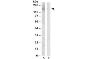 Western blot testing of Jurkat lysate with HER3 antibody at 0. (ERBB3 Antikörper)