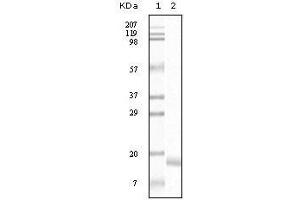 Western Blot showing SNCA antibody used against truncated SNCA recombinant protein. (SNCA Antikörper)