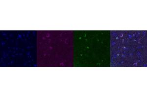 Immunohistochemistry (IHC) image for anti-Kv Channel Interacting Protein 2 (KCNIP2) antibody (ABIN7456001)