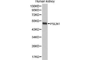Western Blotting (WB) image for anti-Presenilin 1 (PSEN1) (AA 1-160) antibody (ABIN6219418) (Presenilin 1 Antikörper  (AA 1-160))