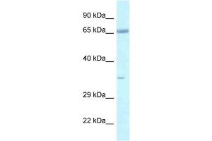 WB Suggested Anti-Lzts1 Antibody   Titration: 1. (LZTS1 Antikörper  (C-Term))
