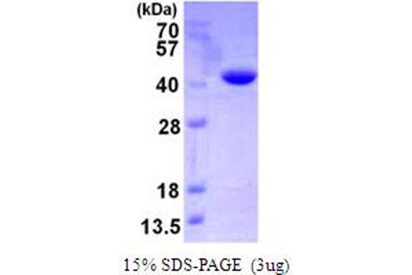 VTA1 Protein (AA 1-307) (His tag)