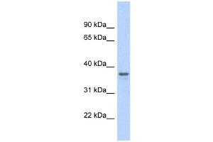GAPDH antibody used at 1 ug/ml to detect target protein. (GAPDH Antikörper  (Middle Region))