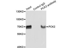 Immunoprecipitation analysis of extracts of HepG2 cells using PCK2 antibody. (PEPCK Antikörper)
