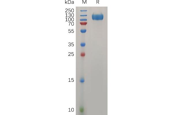 IFNAR1 Protein (AA 28-436) (mFc Tag)