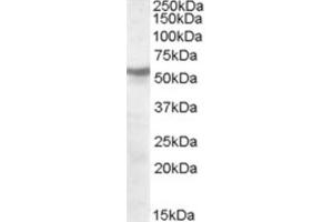 Western Blotting (WB) image for anti-Nicotinic Acetylcholine Receptor beta (CHRNB1) (Internal Region) antibody (ABIN2466671) (CHRNB1 Antikörper  (Internal Region))