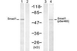 Western blot analysis of extract from 293 cells, untreated or treated with PMA (200nM, 30min), using Smad1 (Ab-465) Antibody (E021321, Lane 1 and 2) and Smad2 (Phospho-Ser465) Antibody (E011321, Lane 3 and 4). (SMAD1 Antikörper)