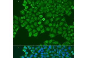 Immunofluorescence analysis of U2OS cells using CAST Polyclonal Antibody at dilution of 1:100. (Calpastatin Antikörper)