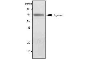 The extract of mouse liver was resolved by SDS-PAGE, transferred to PVDF membrane and probed with anti-human adiponectin antibody (1:2000). (ADIPOQ Antikörper  (AA 15-244))