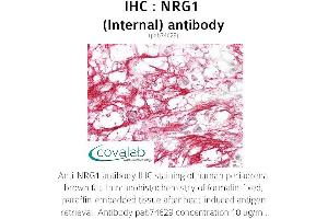 Image no. 1 for anti-Neuregulin 1 (NRG1) (Internal Region) antibody (ABIN5693648) (Neuregulin 1 Antikörper  (Internal Region))
