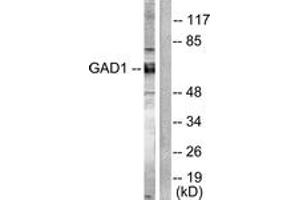 Western blot analysis of extracts from mouse brain cells, using GAD1/2 Antibody. (GAD65+GAD67 (AA 545-594) Antikörper)