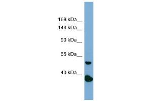 Host:  Rabbit  Target Name:  RAD50  Sample Type:  PANC1 Whole Cell lysates  Antibody Dilution:  1. (RAD50 Antikörper  (N-Term))