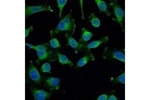 Immunofluorescent analysis of EGFR staining in Hela cells. (EGFR Antikörper)