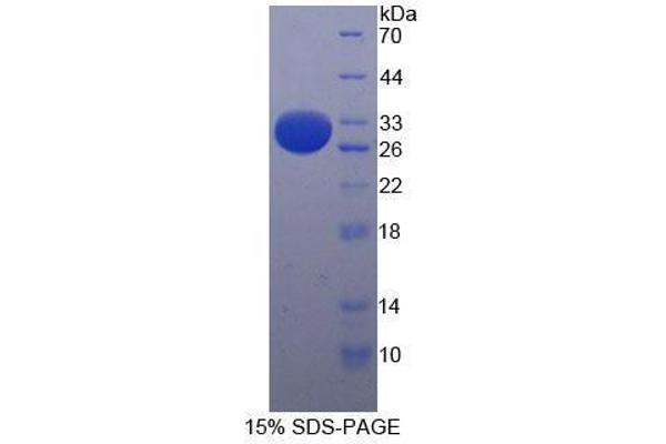 CD103 Protein