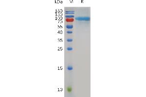 Mouse Q Protein, His Tag on SDS-PAGE under reducing condition. (QSOX1 Protein (AA 36-708) (His tag))