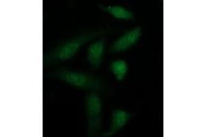 Image no. 2 for anti-Galectin 3 (LGALS3) antibody (ABIN1499247) (Galectin 3 Antikörper)
