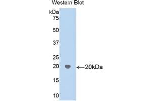 Western blot analysis of recombinant Human HSPD1. (HSPD1 Antikörper  (AA 172-343))