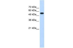 WB Suggested Anti-NR1H2 Antibody Titration:  1. (NR1H2 Antikörper  (N-Term))