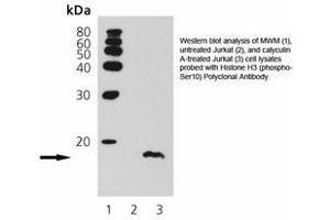 Image no. 1 for anti-Histone 3 (H3) (pSer10) antibody (ABIN363923) (Histone 3 Antikörper  (pSer10))