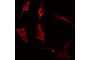 ABIN6275088 staining  Hela cells by IF/ICC. (MARCH3 Antikörper  (Internal Region))