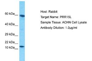 Host: Rabbit Target Name: PRR15L Sample Tissue: Human ACHN Whole Cell Antibody Dilution: 1ug/ml (PRR15L Antikörper  (C-Term))