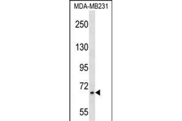 Zinc Finger Protein 44 Antikörper  (N-Term)