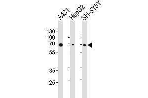 Western blot analysis of lysates from A431, HepG2, SH-SY5Y cell line (from left to right), using EIF2AK2 Antibody (ABIN6243641 and ABIN6577090). (EIF2AK2 Antikörper  (AA 1-250))