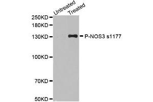 Western blot analysis of extracts of various cell lines, using Phospho-NOS3-S1177 antibody (ABIN2988223). (ENOS Antikörper  (pSer1177))
