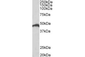 Western Blotting (WB) image for anti-Interferon Regulatory Factor 4 (IRF4) (AA 433-445) antibody (ABIN1102606) (IRF4 Antikörper  (AA 433-445))