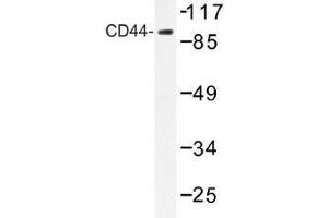 Image no. 1 for anti-CD44 (CD44) antibody (ABIN317946) (CD44 Antikörper)