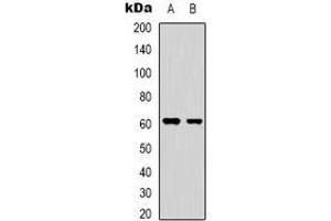 Western blot analysis of YTHDF1 expression in HepG2 (A), HEK293T (B) whole cell lysates. (YTHDF1 Antikörper  (N-Term))
