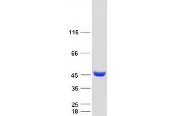 AADAT Protein (Transcript Variant 1) (Myc-DYKDDDDK Tag)