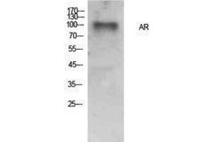 Western Blotting (WB) image for anti-Androgen Receptor (AR) (Internal Region) antibody (ABIN3178884) (Androgen Receptor Antikörper  (Internal Region))