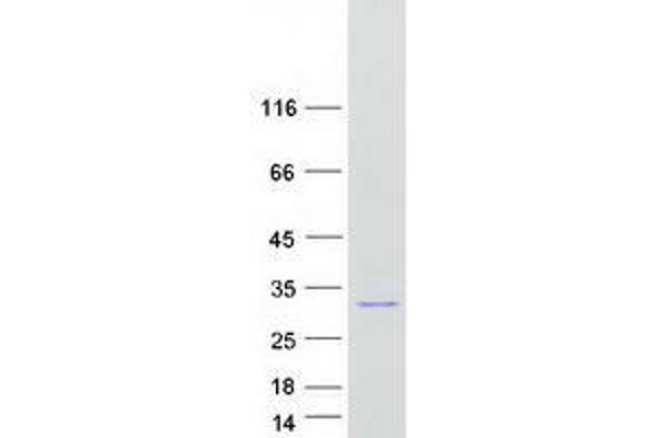 UBE2E2 Protein (Myc-DYKDDDDK Tag)