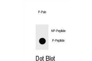 Dot blot analysis of Phospho-IKKB- Antibody Phospho-specific Pab g on nitrocellulose membrane. (IKBKB Antikörper  (pSer672))