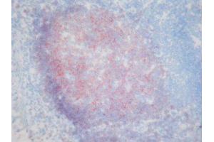 Immunohistochemistry (IHC) image for anti-CD19 Molecule (CD19) antibody (ABIN781711) (CD19 Antikörper)