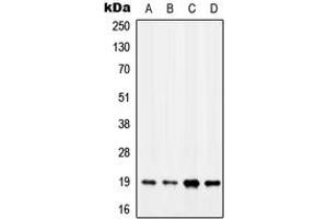 Western blot analysis of MYL7 expression in MCF7 (A), K562 (B), SP2/0 (C), H9C2 (D) whole cell lysates. (MYL7 Antikörper  (Center))