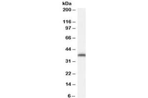 Western blot testing of NIH3T3 cell lysate with ARA9 antibody at 0. (AIP Antikörper)