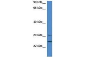 Image no. 1 for anti-14-3-3 alpha + beta (YWHAB) (AA 70-119) antibody (ABIN6746013) (YWHAB Antikörper  (AA 70-119))