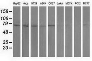 Image no. 2 for anti-Pseudouridylate Synthase 7 Homolog (PUS7) antibody (ABIN1500516) (PUS7 Antikörper)