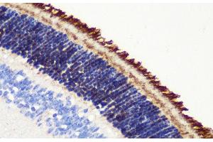 Immunohistochemistry of paraffin-embedded Mouse retina using PDE6B Polyclonal Antibody at dilution of 1:200 (40x lens). (PDE6B Antikörper)