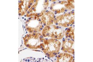 Paraformaldehyde-fixed, paraffin embedded SAMPLE tissue, Antigen retrieval by boiling in sodium citrate buffer (pH6. (BCL10 Antikörper)