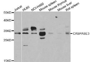 Western blot analysis of extracts of various cell lines using CASP3 antibody. (Caspase 3 Antikörper)