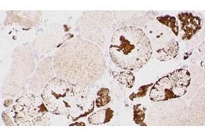 Immunohistochemistry (IHC) image for anti-Myotilin (MYOT) (C-Term) antibody (ABIN7538828) (Myotilin Antikörper  (C-Term))