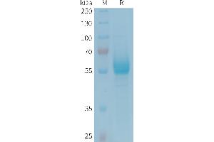 Human CD161 Protein, hFc Tag on SDS-PAGE under reducing condition. (CD161 Protein (Fc Tag))
