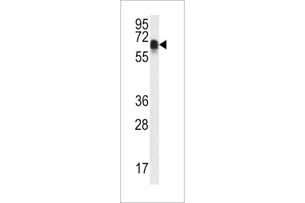 CCDC102A Antikörper  (C-Term)