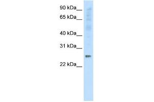 WB Suggested Anti-SNAP25 Antibody Titration:  0. (SNAP25 Antikörper  (C-Term))