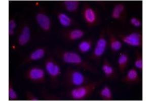 Image no. 1 for anti-Myocyte Enhancer Factor 2A (MEF2A) (pThr312) antibody (ABIN196683) (MEF2A Antikörper  (pThr312))
