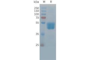 Cynomolgus TIGIT Protein, hFc Tag on SDS-PAGE under reducing condition. (TIGIT Protein (AA 27-209) (Fc Tag))